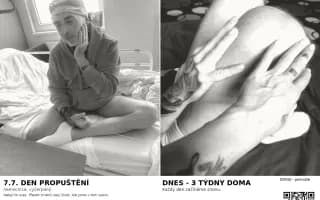 „Kdy mě pustěj?“ – Erikova cesta zpět do života