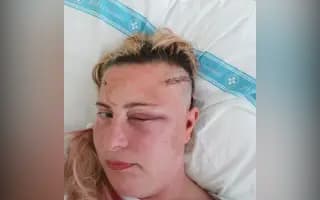 Podpořili jste léčbu nádoru mozku