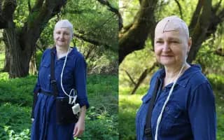 Sbírka na léčbu pro maminku Jáju s mozkovým nádorem